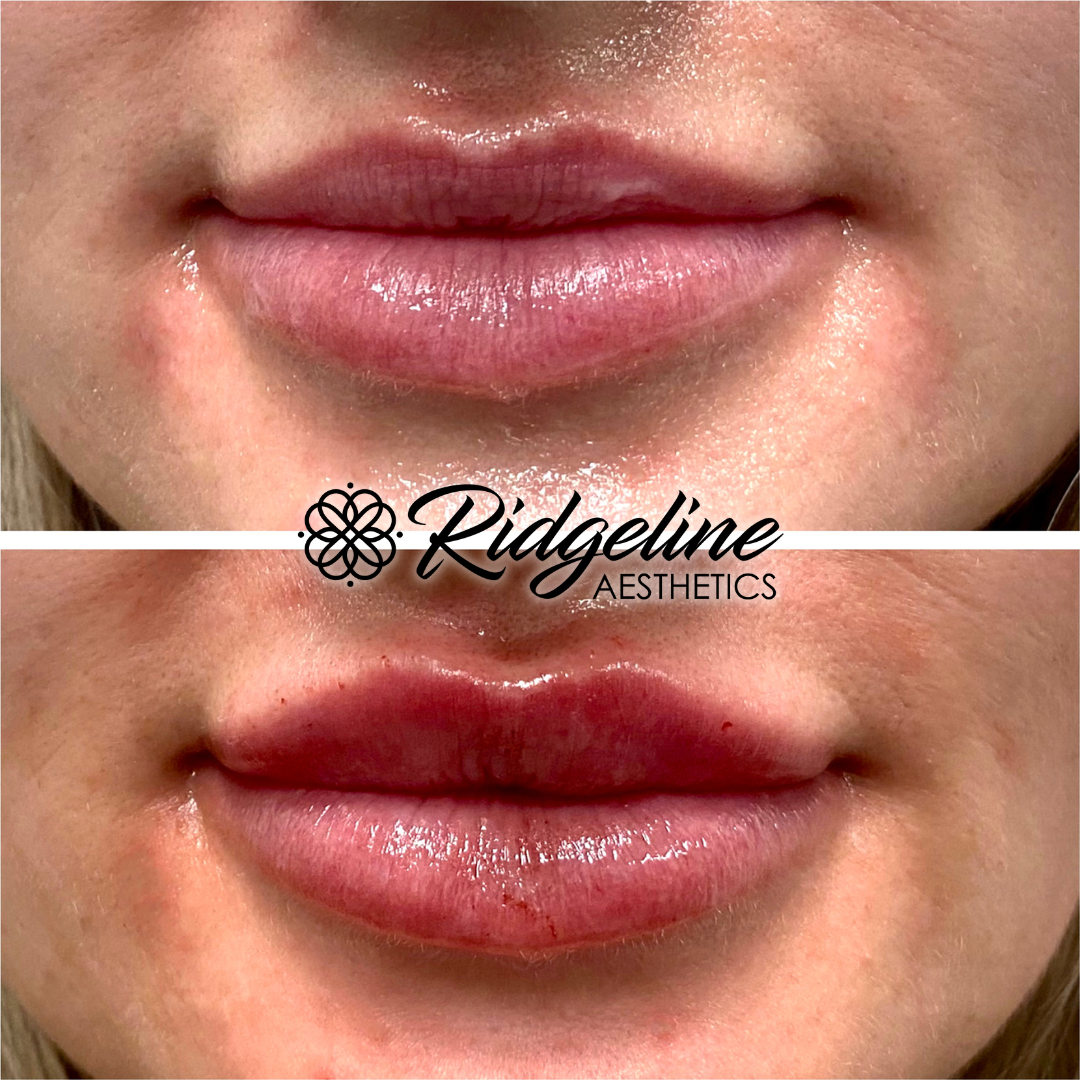 Face & Body Sculpting (2)