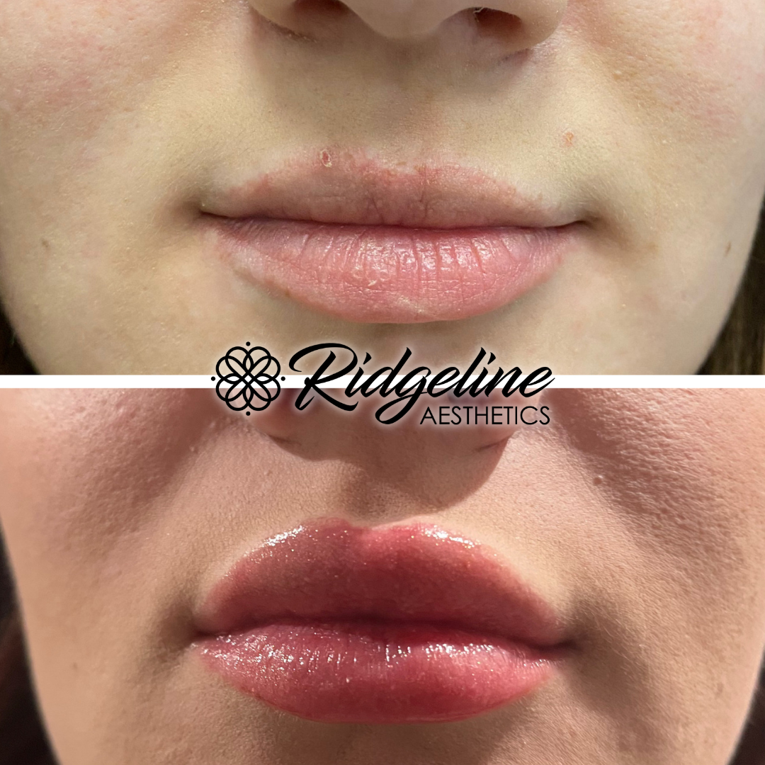 Face & Body Sculpting (2)