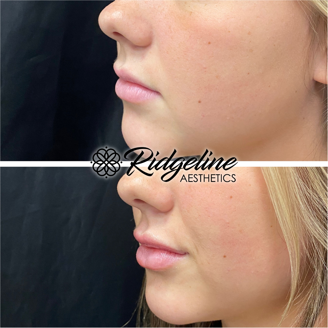 Face & Body Sculpting (3)