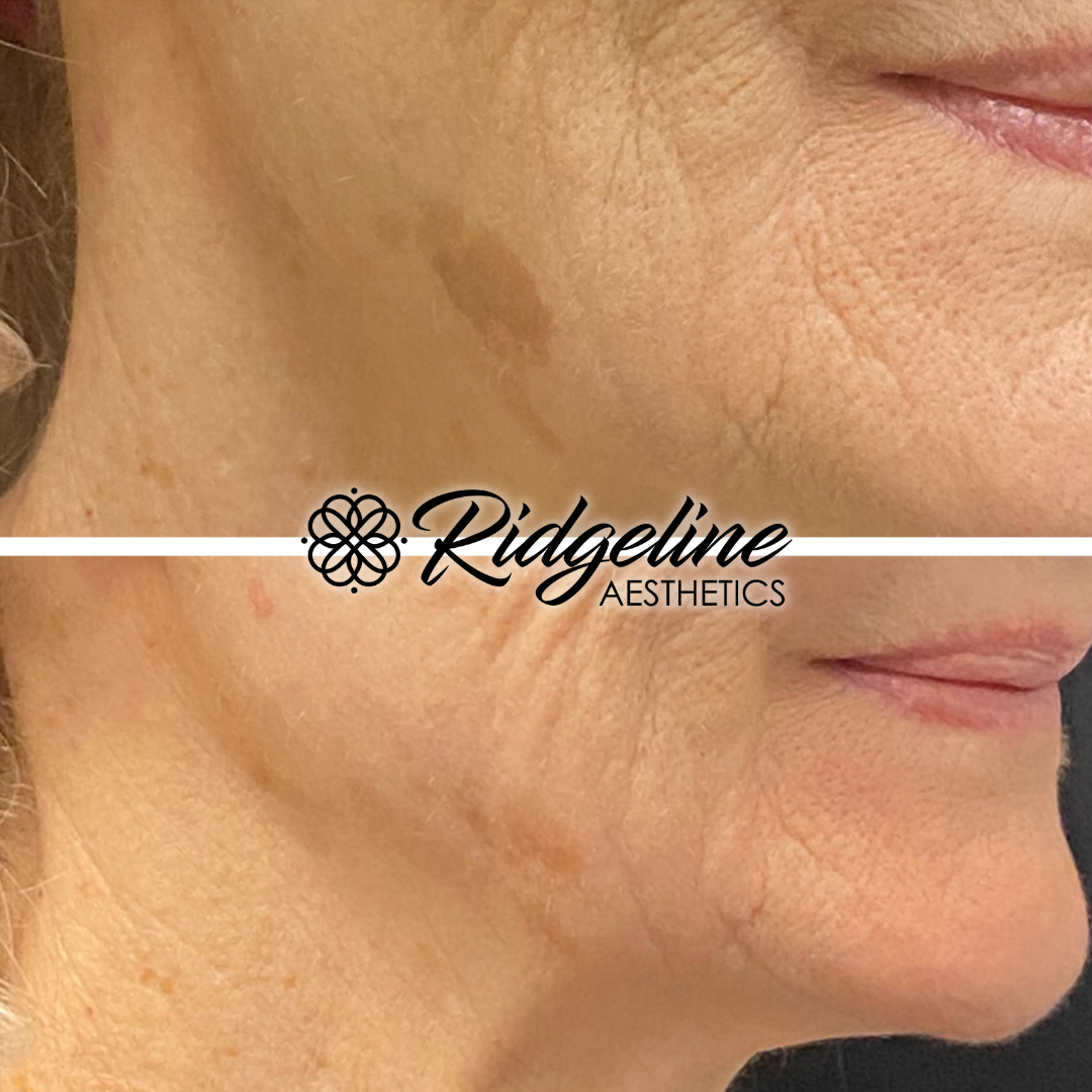 Face & Body Sculpting (4)