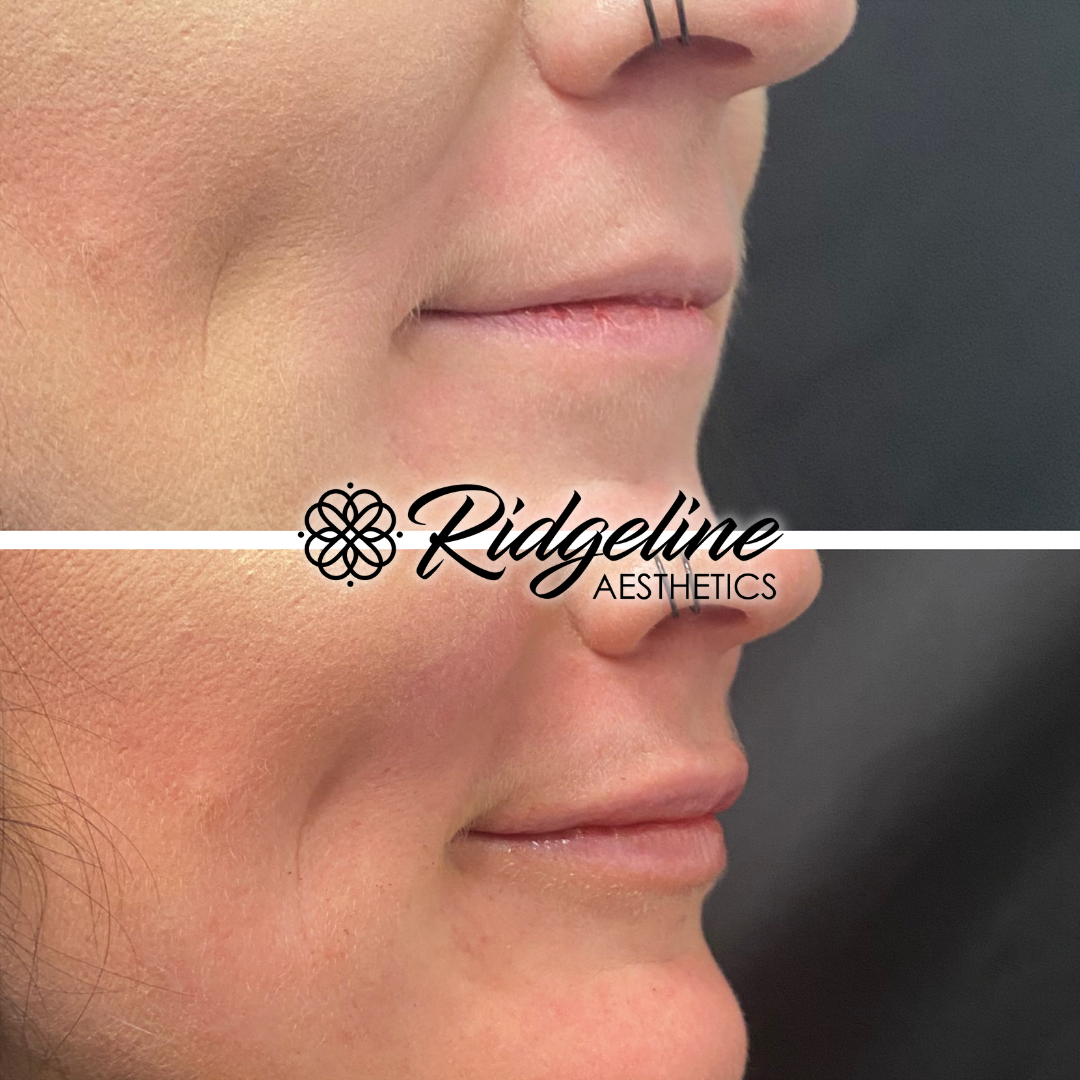 Face & Body Sculpting