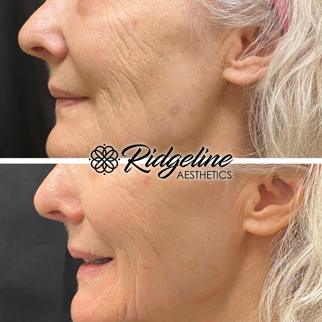 Face & Body Sculpting (5)