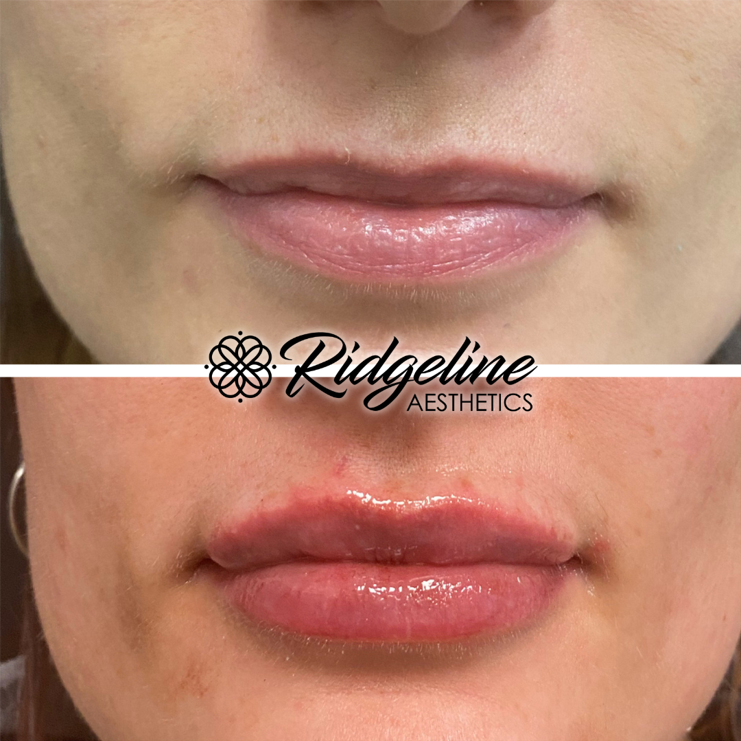 Face & Body Sculpting