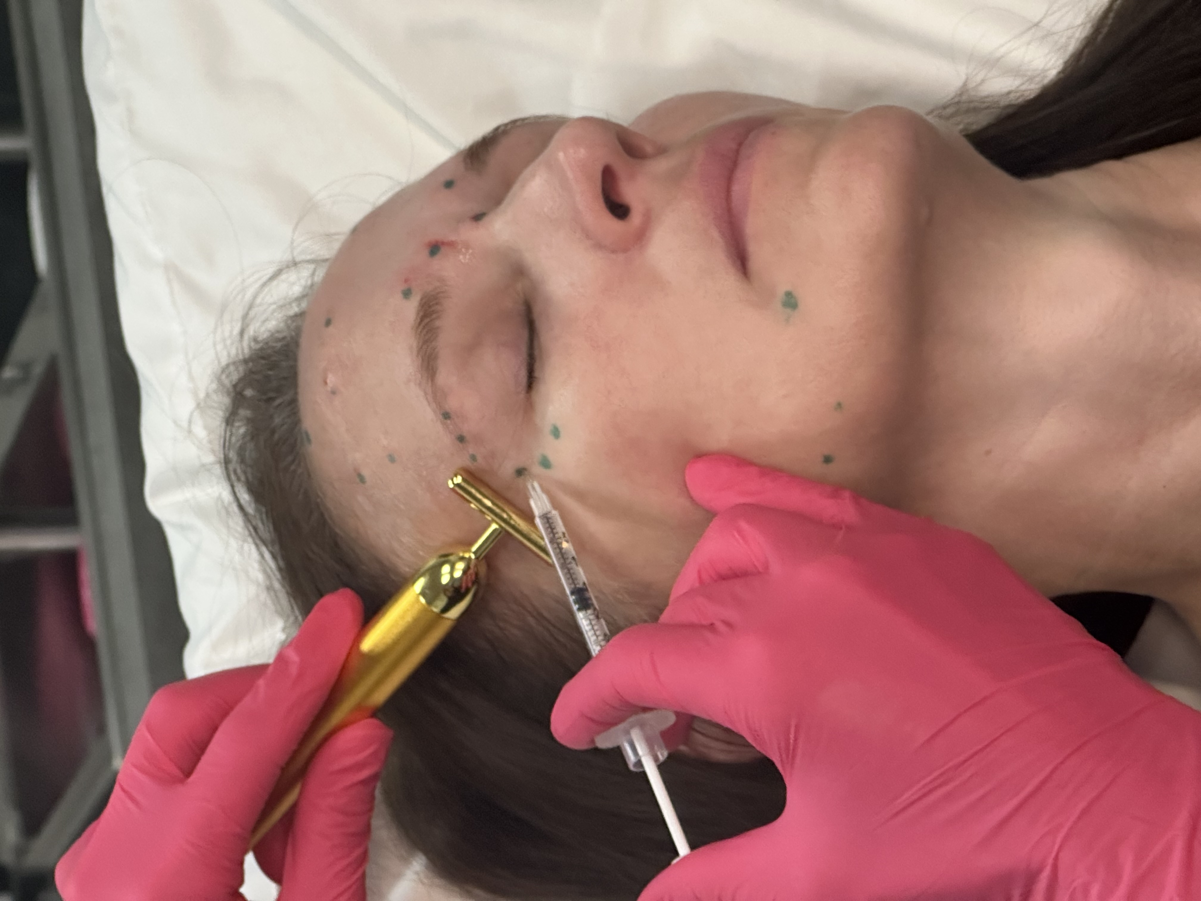 Clinician performing a guided facial injection treatment at Ridgeline