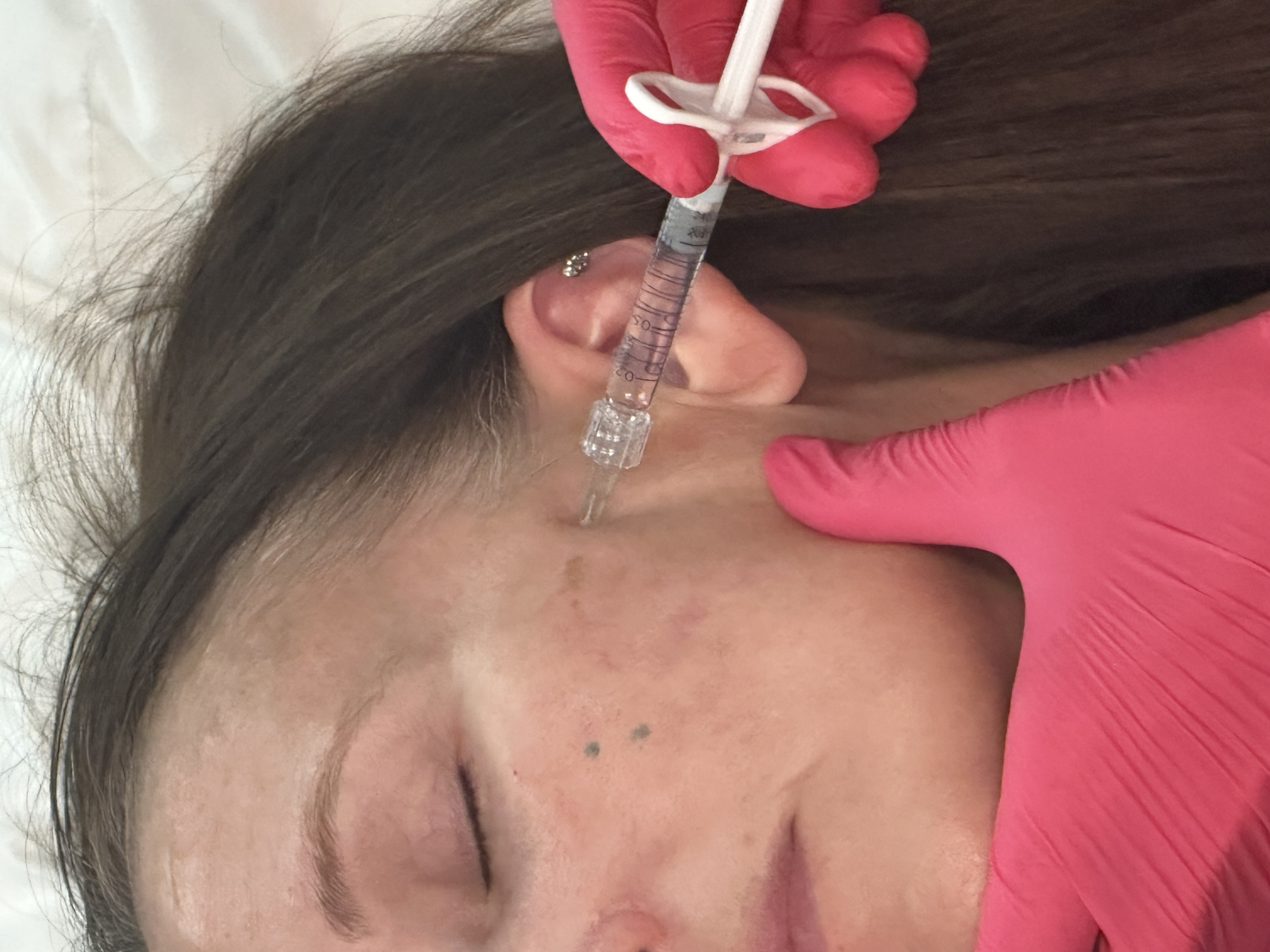Provider administering a facial injection to a reclining client in the clinic.