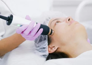 woman recieving micro-needling treatment